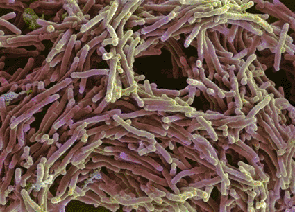 Image: Colored scanning electron micrograph (SEM) of Mycobacterium tuberculosis bacteria (photo courtesy A. Dowsett, Health Protection Agency).